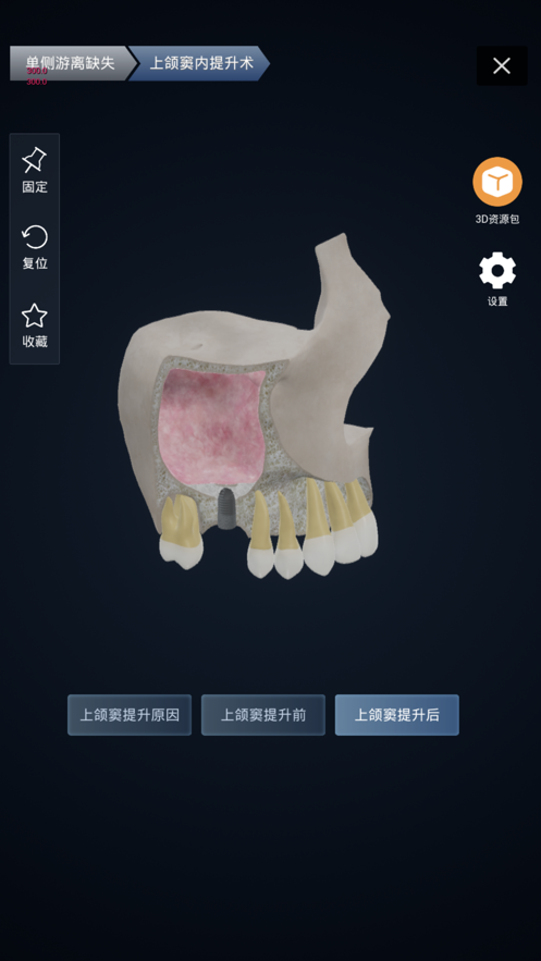聊牙截图